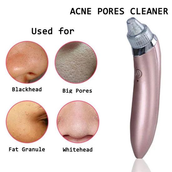 Vacuum Blackhead Remover Pore Cleaner