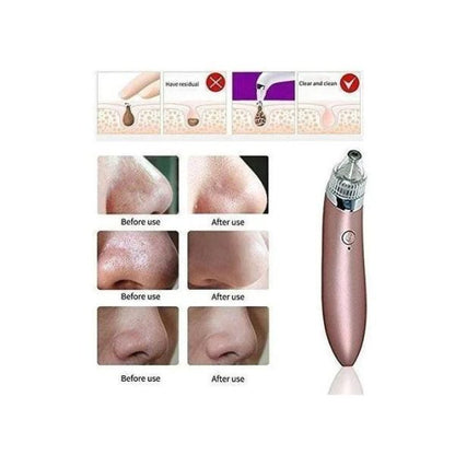 Vacuum Blackhead Remover Pore Cleaner