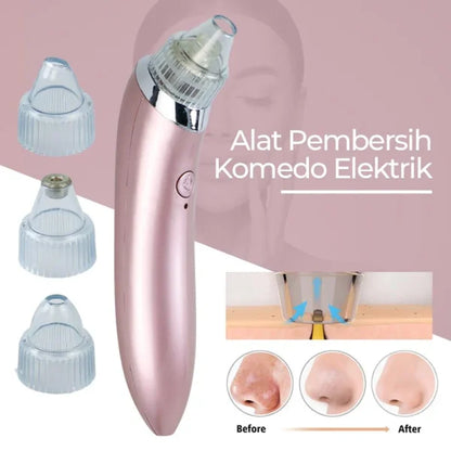 Vacuum Blackhead Remover Pore Cleaner